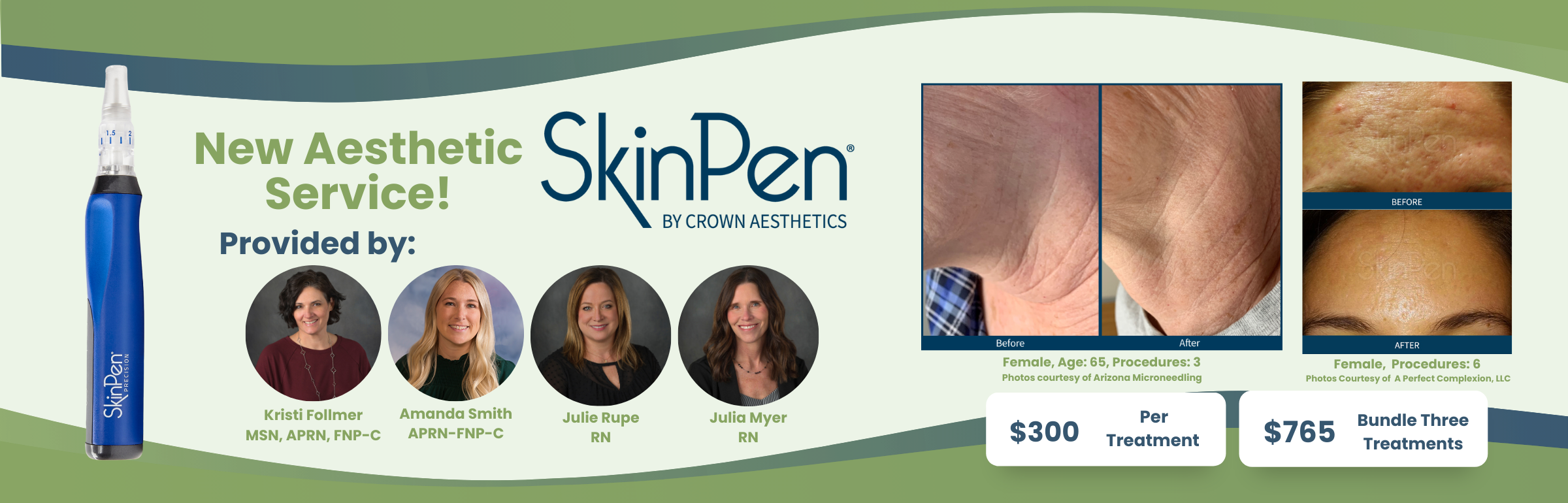 New Aesthetic Service, the Skin Pen, provided by Krisi Follmer, Amanda Smith, Julie Rupe, and Julia Myer. featuring before and after images of skin before and after the Skin Pen